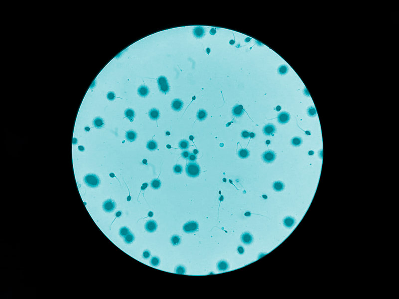Analisis-de-fragmentacion-de-DNA-en-semen-y-pruebas-dinamicas